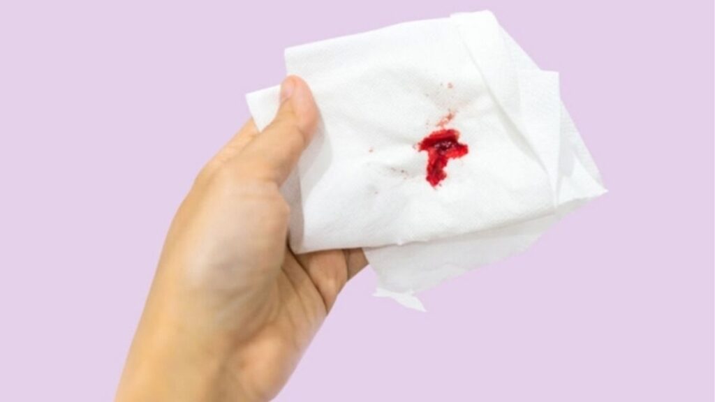 Dấu hiệu chảy máu sau quan hệ cần khám phụ khoa