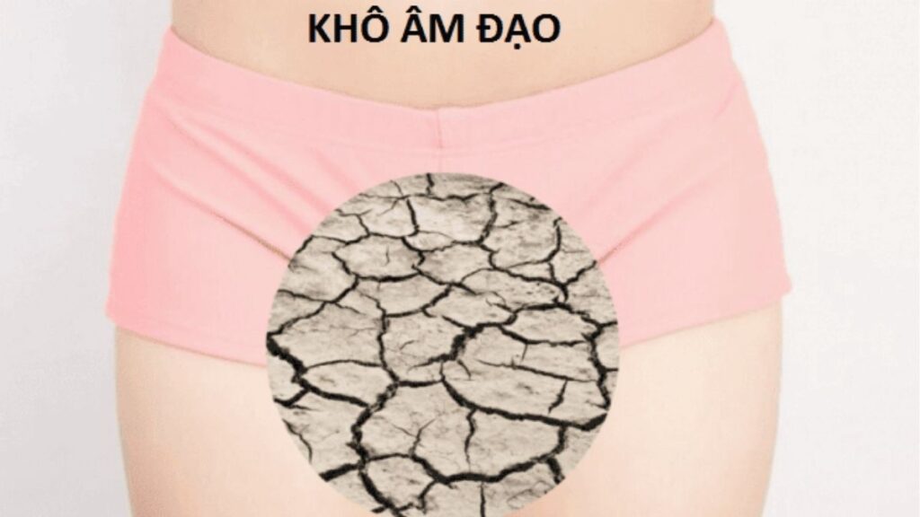 Hình minh họa cơ chế thiếu bôi trơn làm tăng ma sát và gây cảm giác nóng rát, khó chịu khi quan hệ.