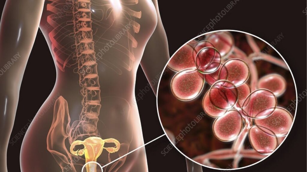 Vị trí đau cửa âm đạo và đau sâu vùng chậu khi quan hệ